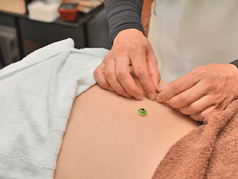 ぎっくり腰など